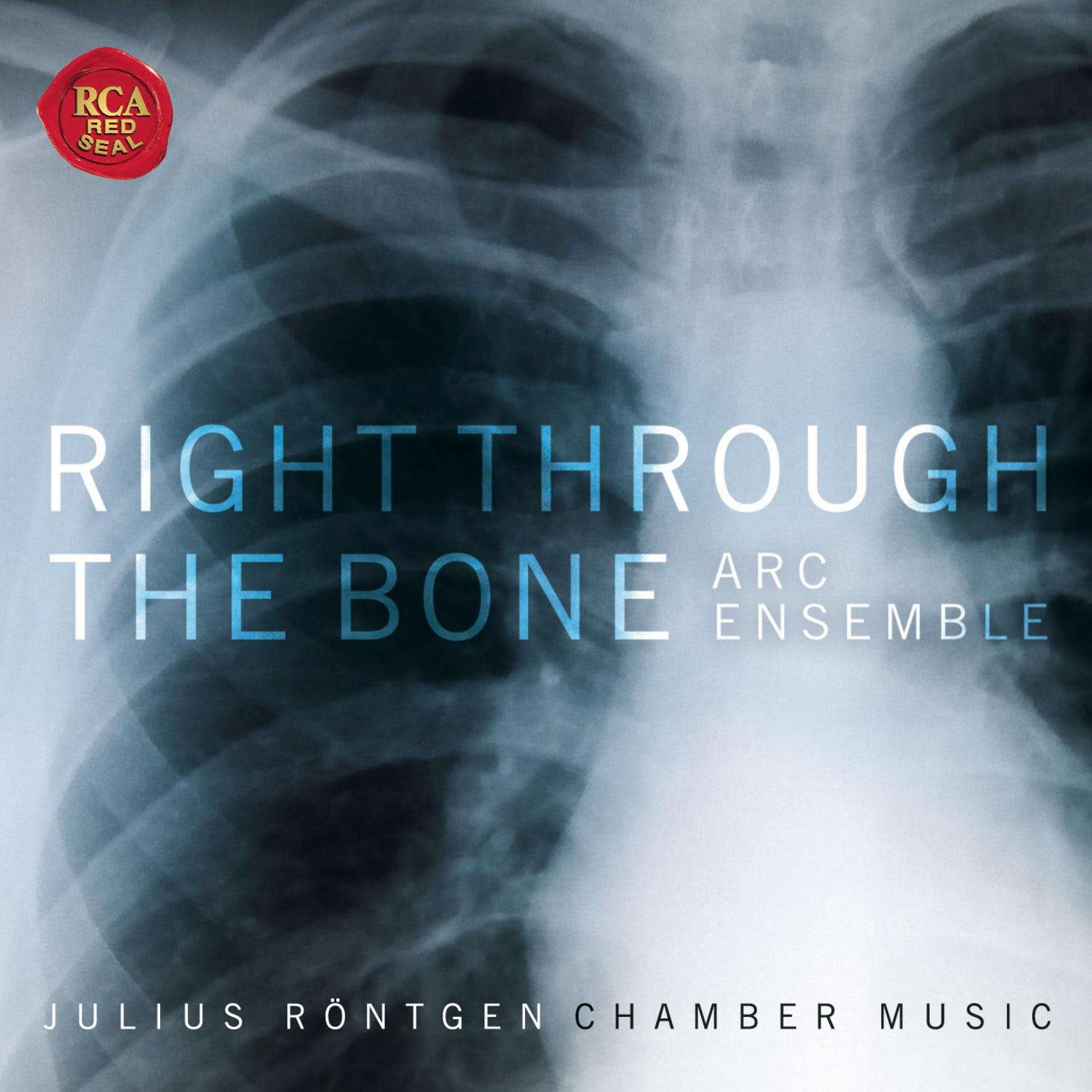 Right Through the Bone - Julius Röntgen